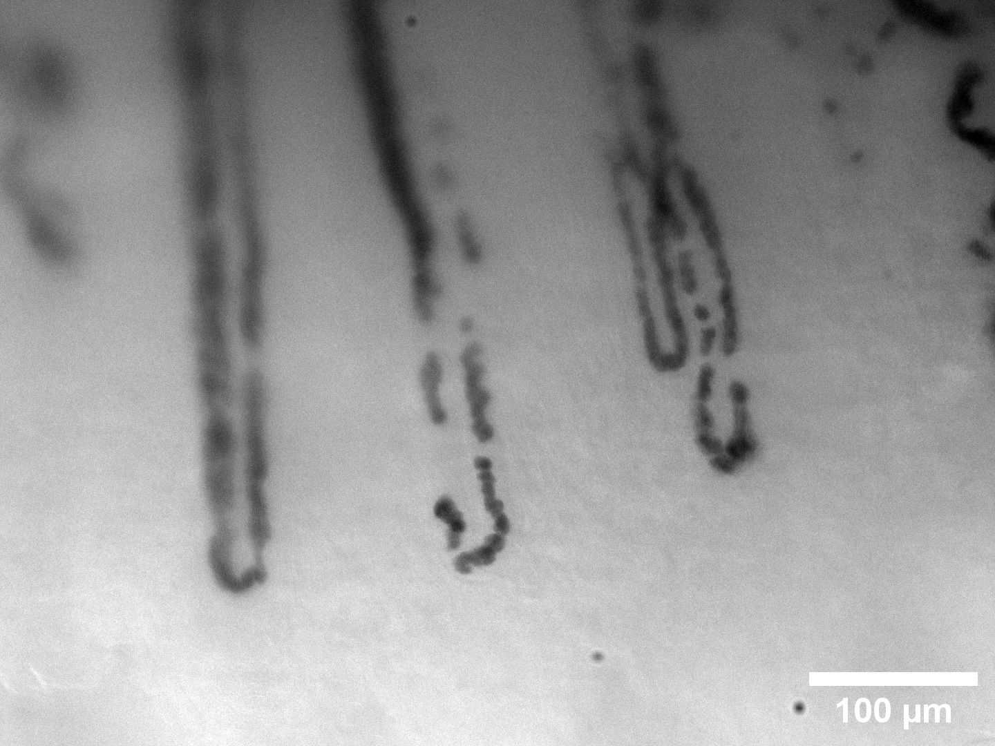 Nailfold capillaries at 10x magnification
